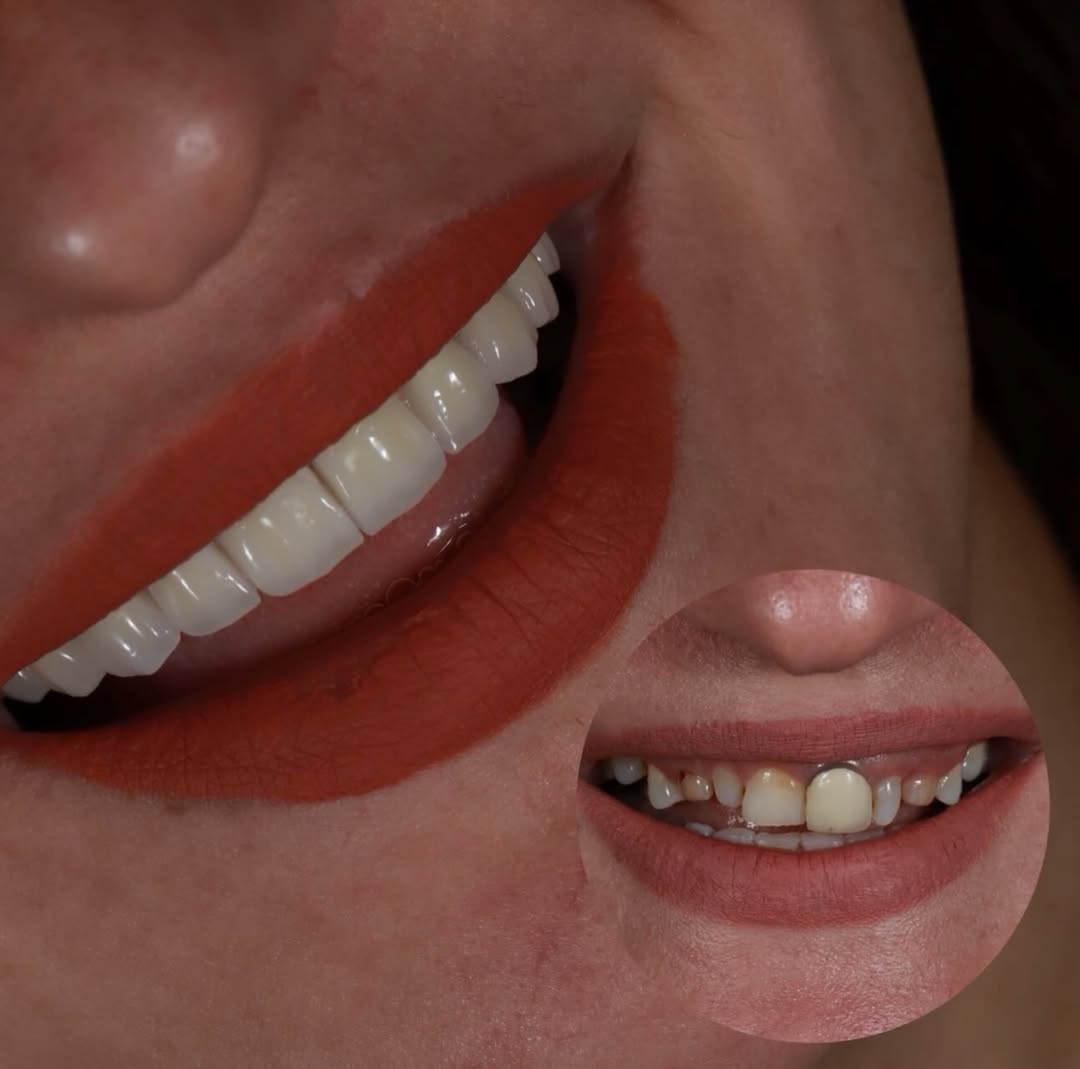 Dental treatments in Turkey 