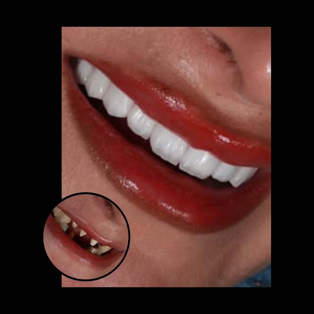 Dental treatments in Antalya 