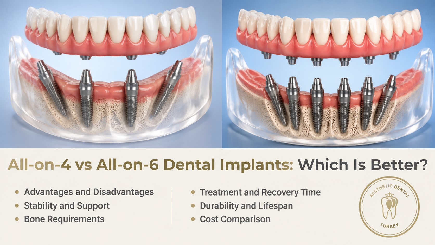 All-on-4 vs All-on-6 Dental Implants: Which Is Better?