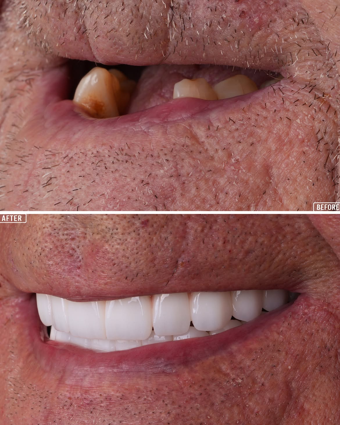 All on 4 Before & After 10