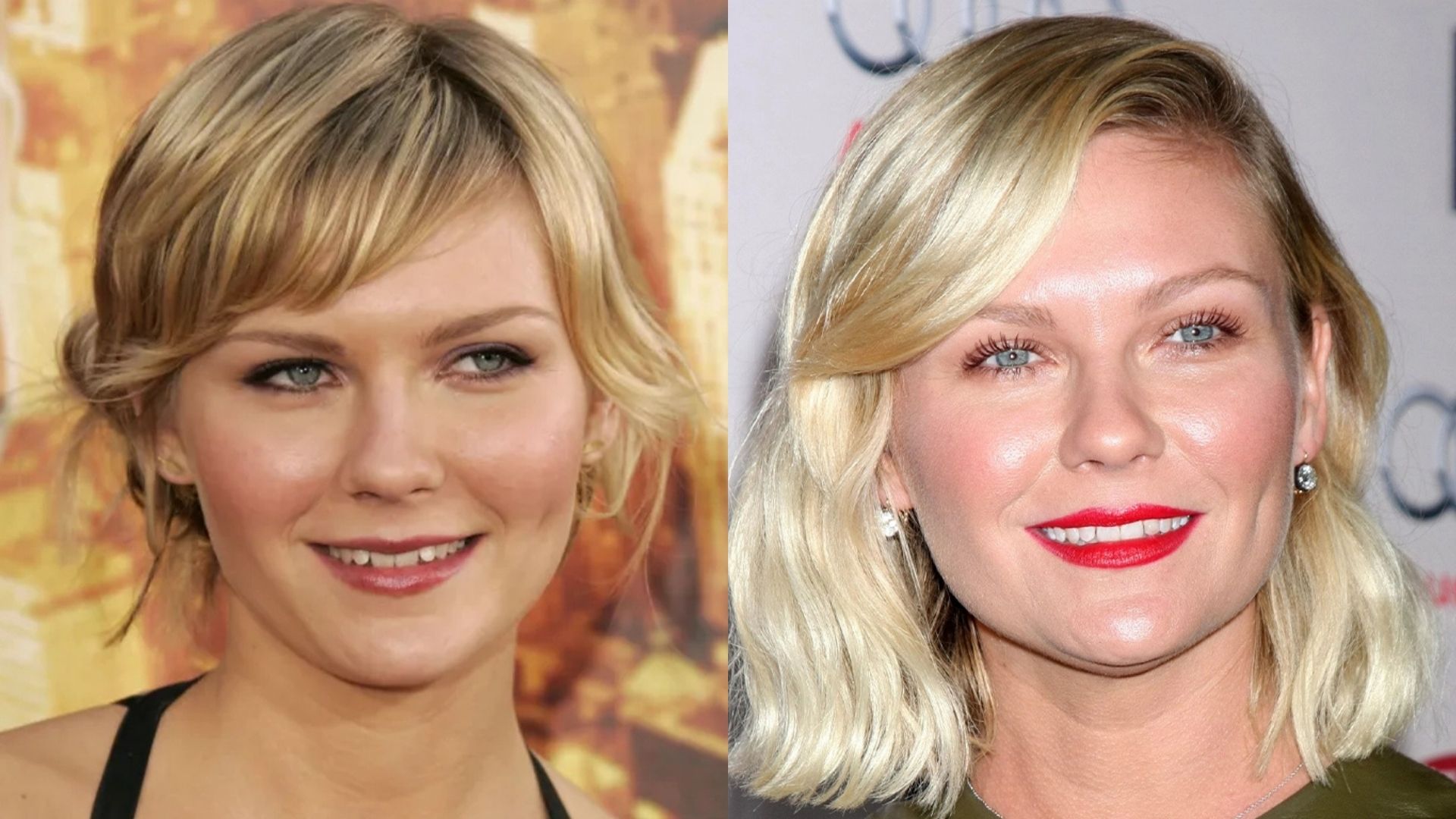 Kirsten Dunst's Teeth before and after 