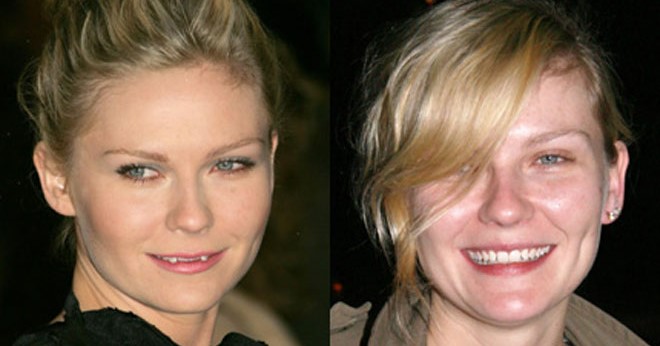 Kirsten Dunst's Teeth before and after 