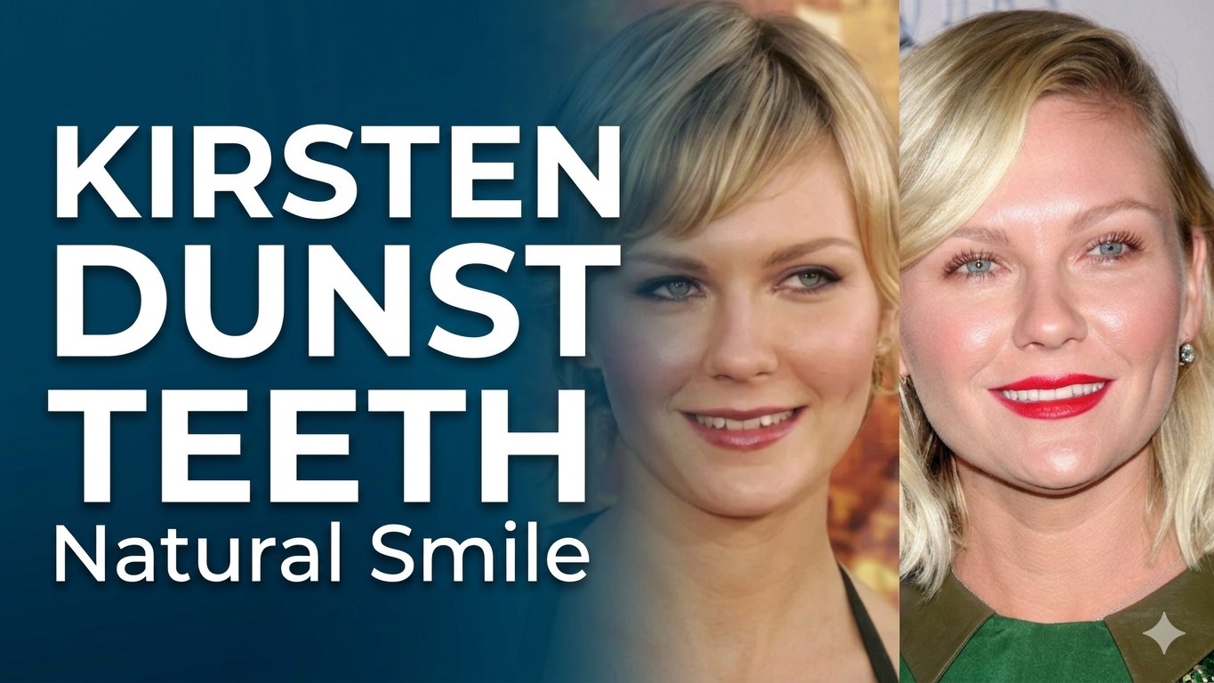Kirsten Dunst's Teeth 