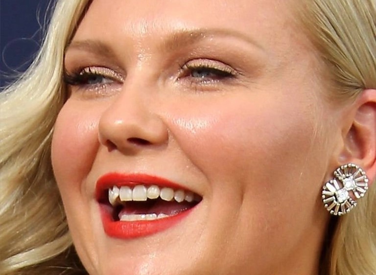Kirsten Dunst's Teeth Whitening  