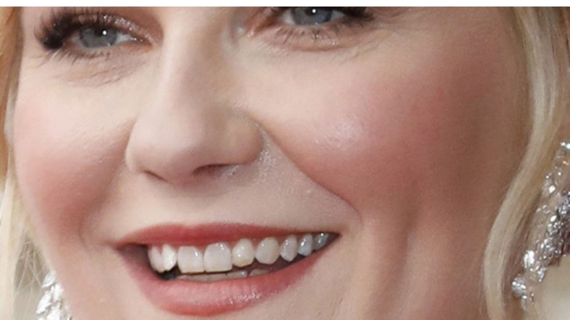 Kirsten Dunst's Teeth Veneers  