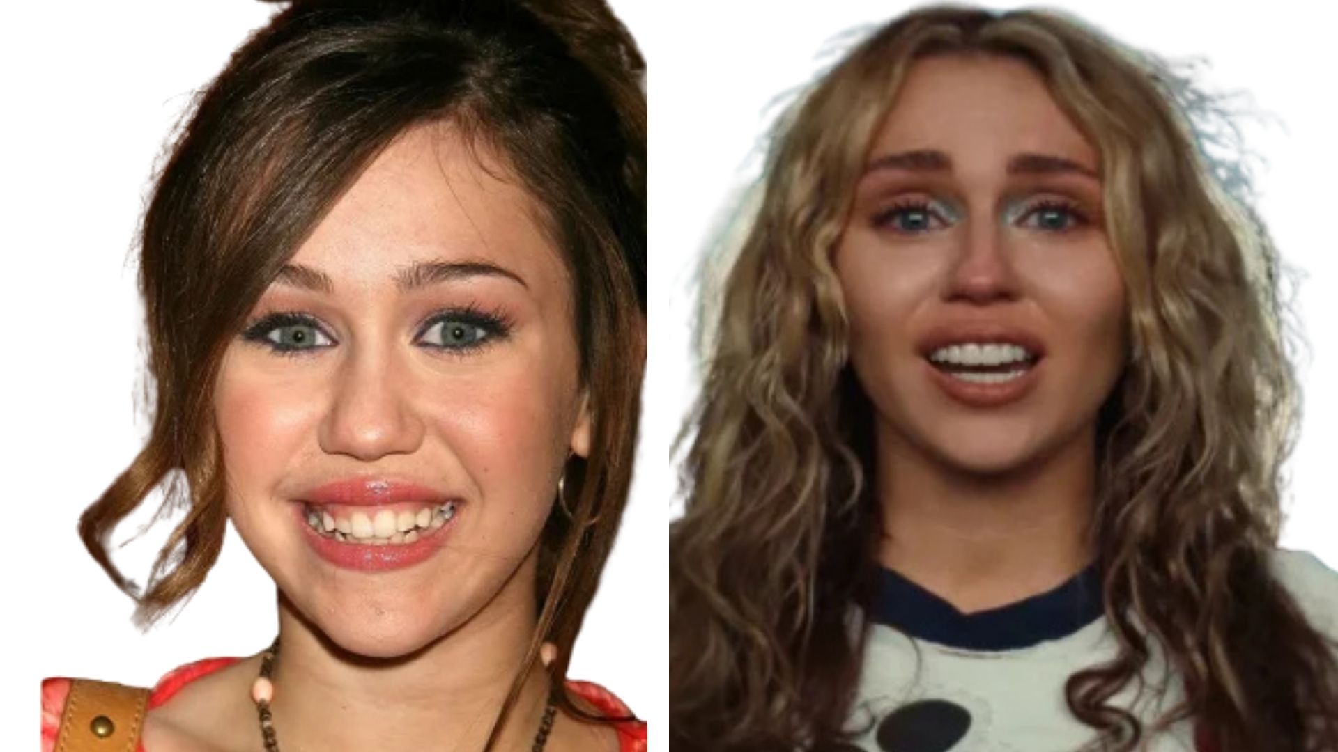 Miley Cyrus Teeth Before and After 