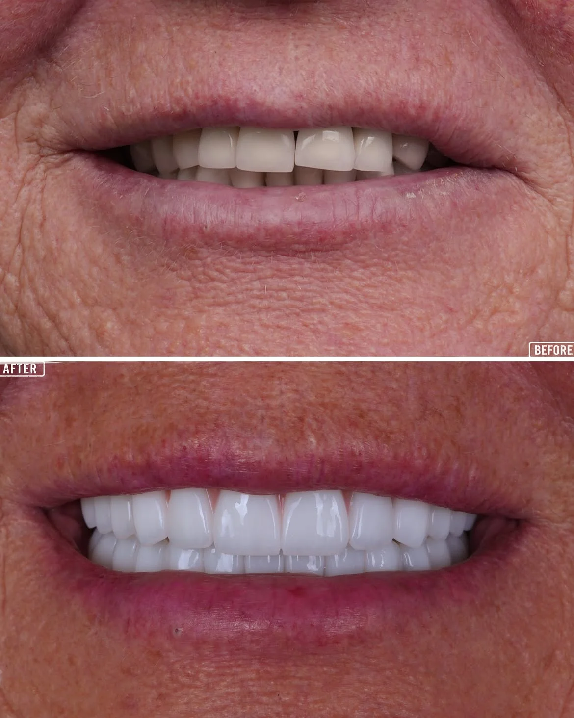 All on 6 Before & After 4