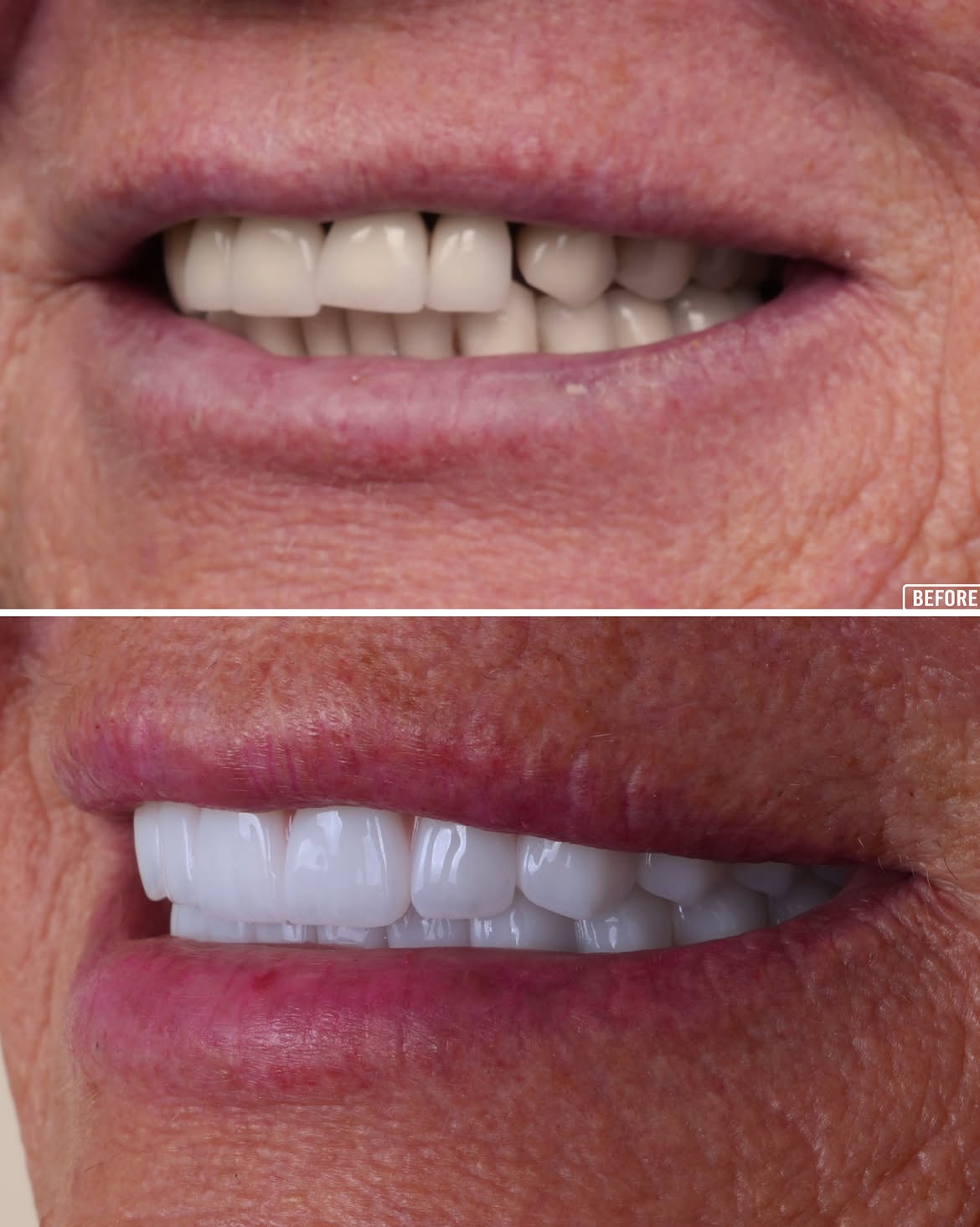 All on 6 Before & After 5