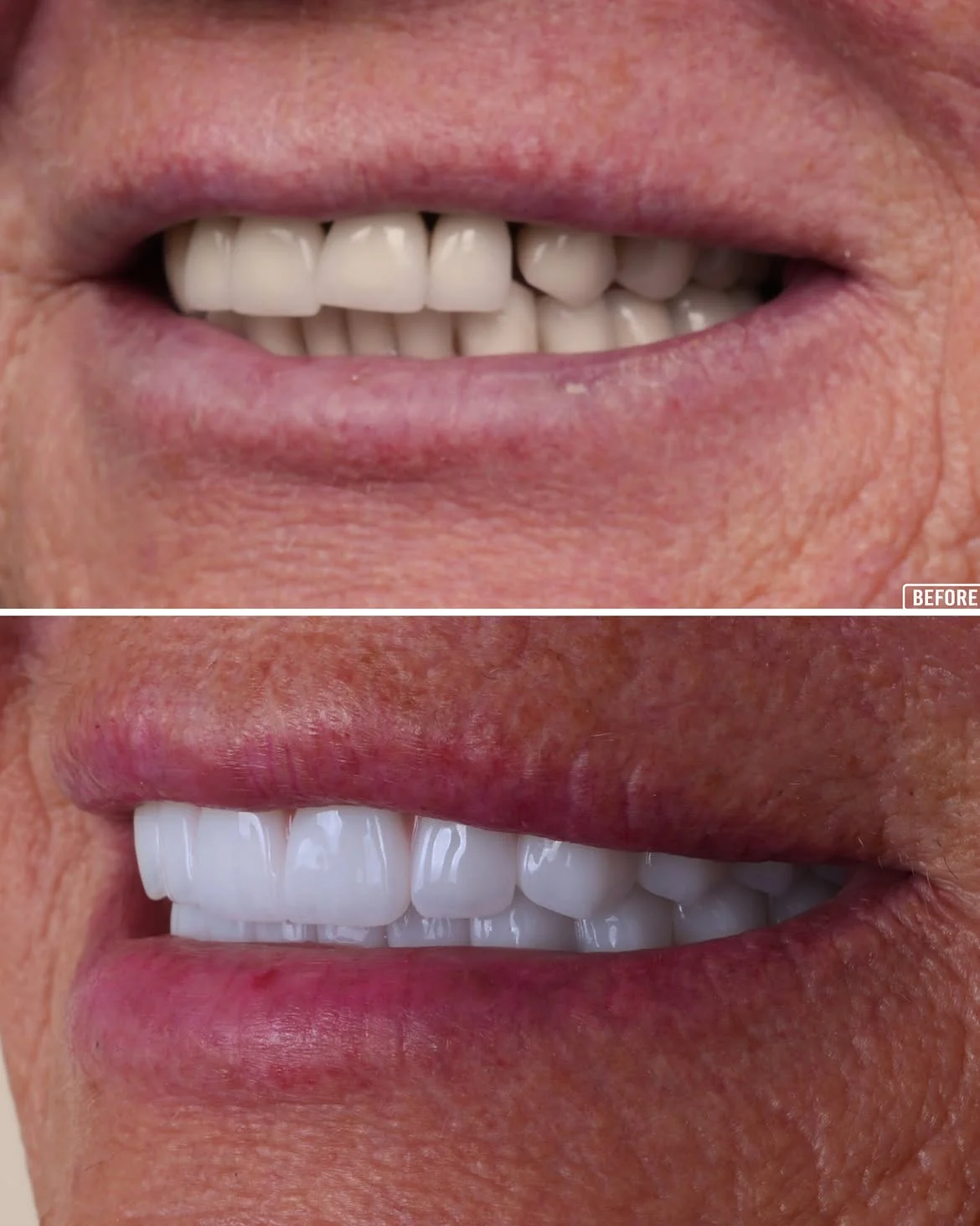 All on 6 Before & After 5