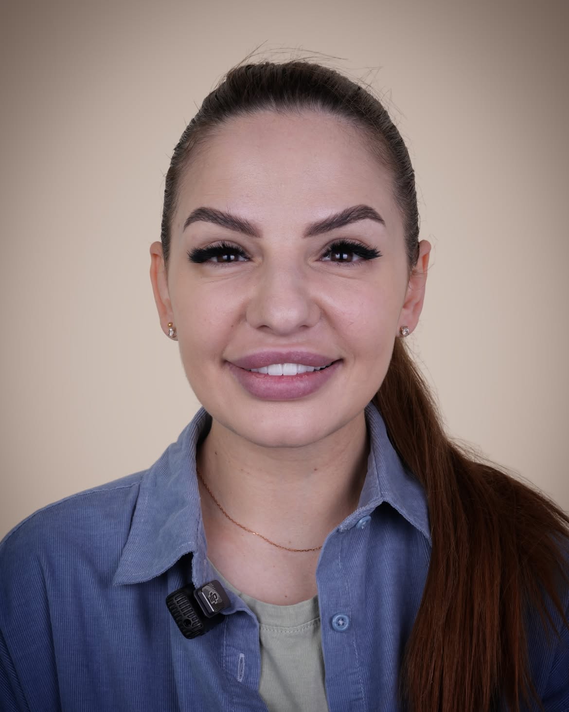 Turkey Teeth Veneers before and after 13