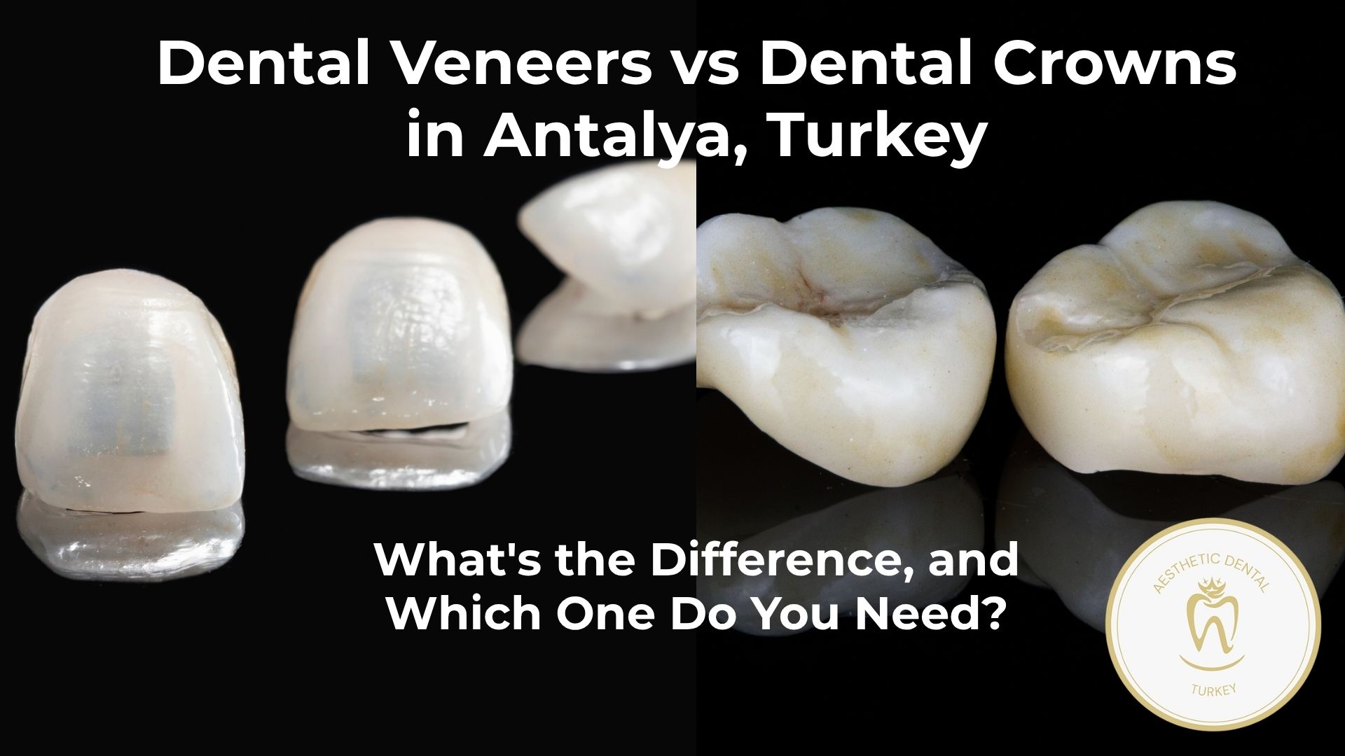 Veneers vs Crowns in Antalya, Turkey: What's the Difference and Which Do You Need?
