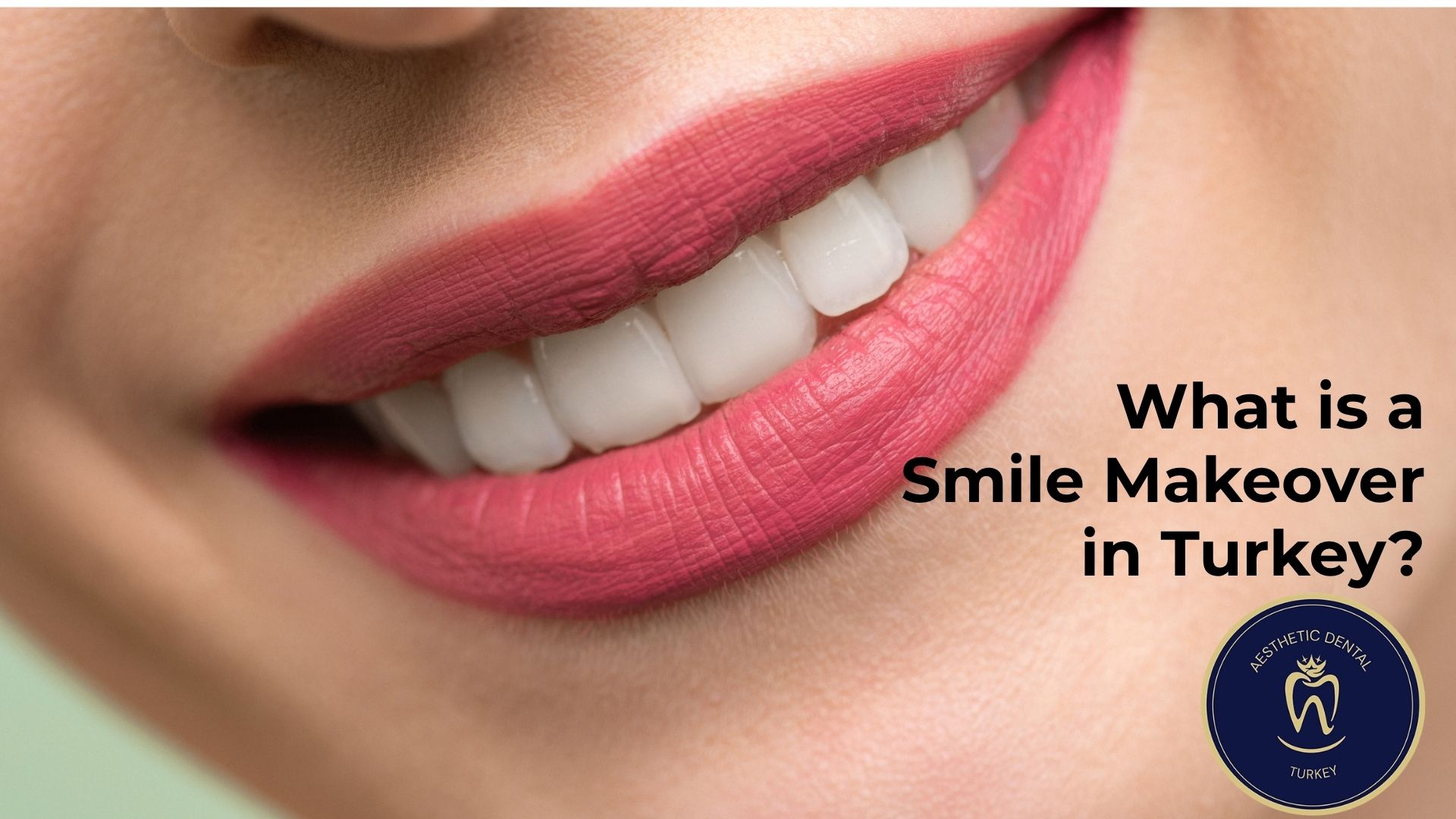 what-is-a-smile-makeover-turkey-antalya?