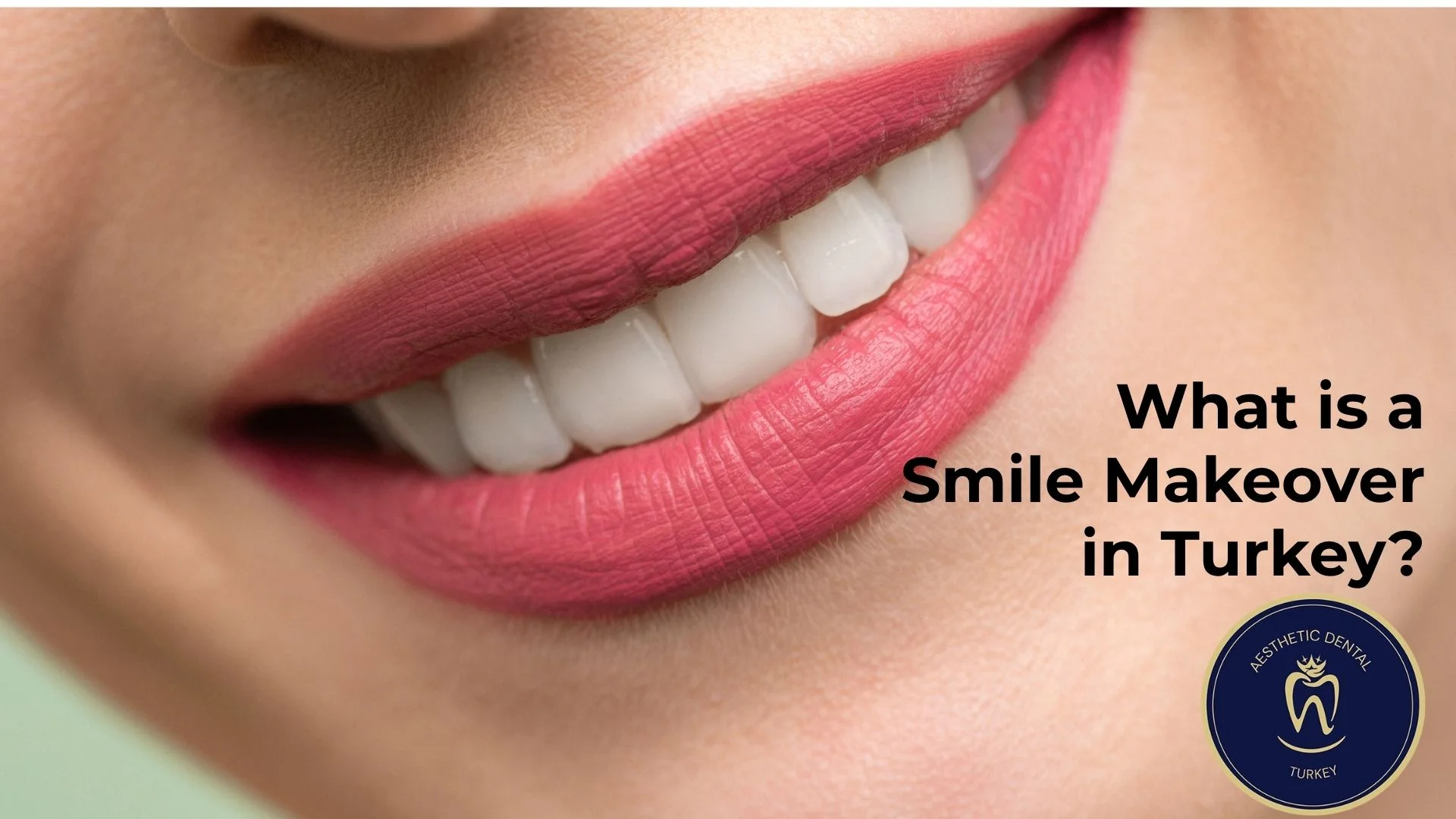 what-is-a-smile-makeover-turkey-antalya?